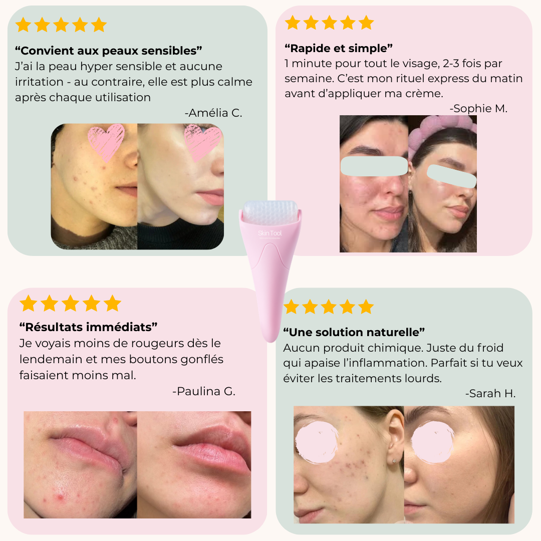 Cryo Roller Zéro Imperfections